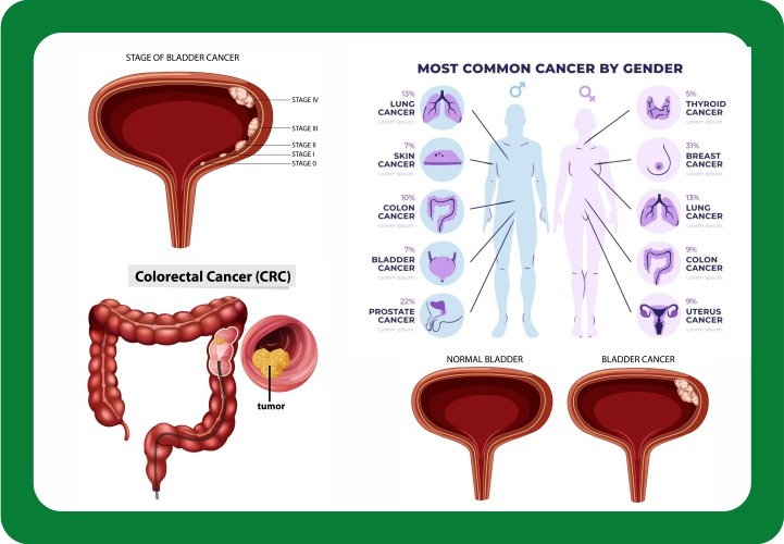 Cancer