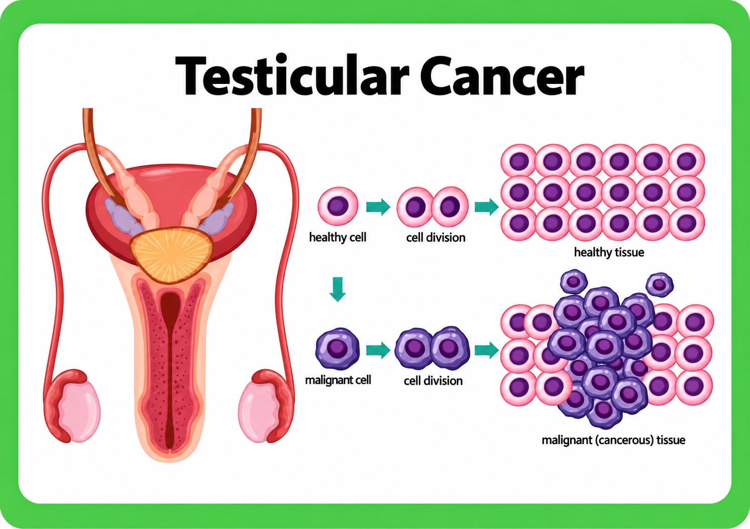Diseases Of The Male Reproductive System